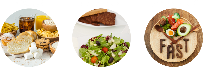 太るメカニズム：脂肪細胞の肥大化